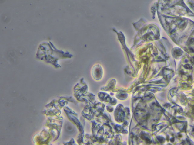 Botryobasidium con spore finemente verrucose